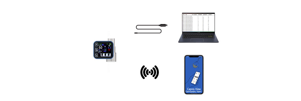 anesthesia machine oxygen analyzer