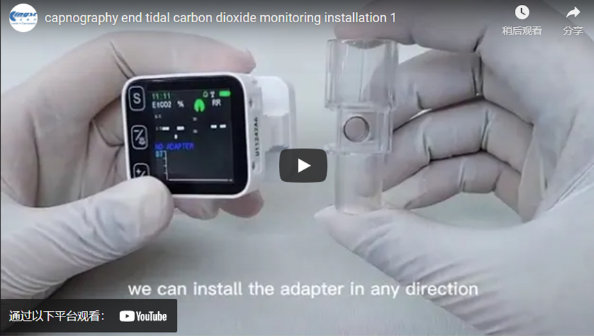 Capnography End Tidal CO2 Monitoring Products Installation