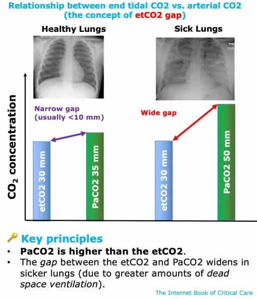 advanced-application-of-etco2.png